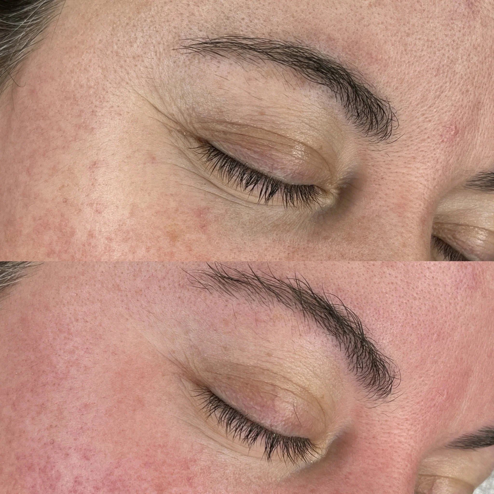 Reduced eye tension (1 session)