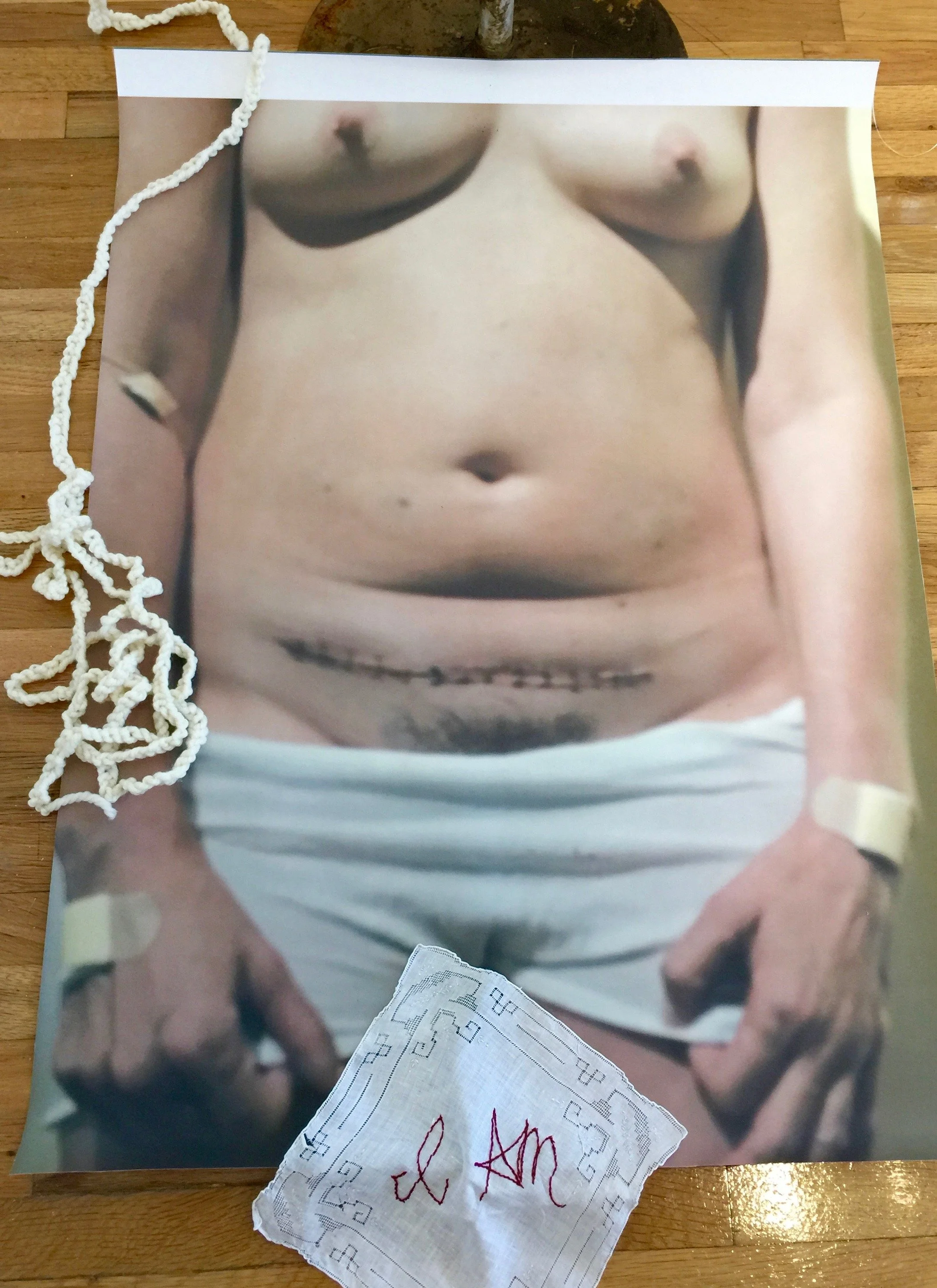  "Stictched. Apart." Triptych Left Panel.


I came home with my body split open.
Stitches still wet with truth.
No flowers. No soft light.
Just skin holding itself together by force.

This is not recovery.
This is impact.

I did not hide the wound.
I