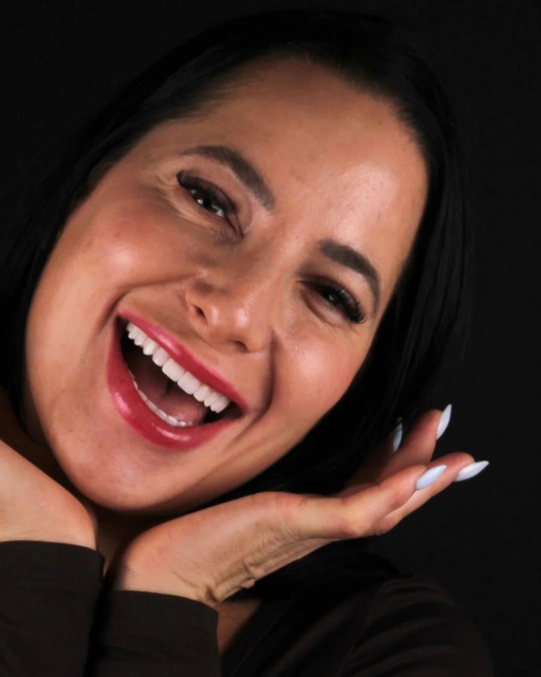 One of the most overlooked benefits of veneers is how they support the face, not just the teeth.⁠
⁠
By restoring length, volume, and proper bite position, veneers can subtly lift the lower third of the face, soften the profile, and create a more yout