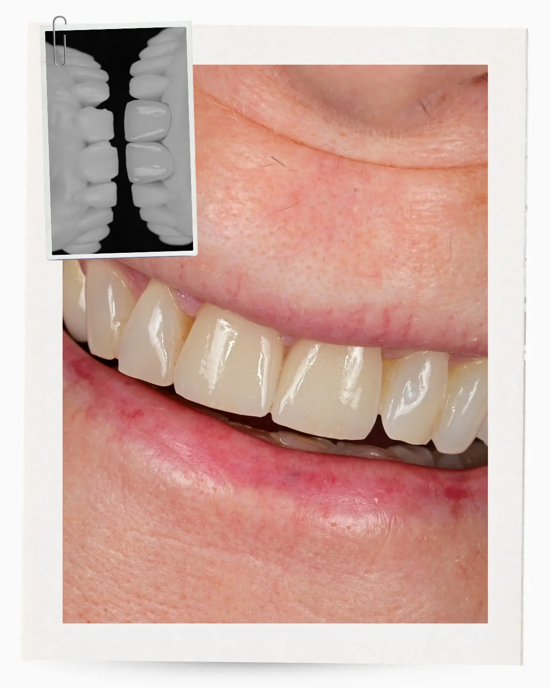 There is something meaningful about seeing a smile at two different moments in time.⁠
⁠
The before shows the starting point. The after reflects the result of careful planning, structural changes, and thoughtful design working together. ⁠
⁠
When propo