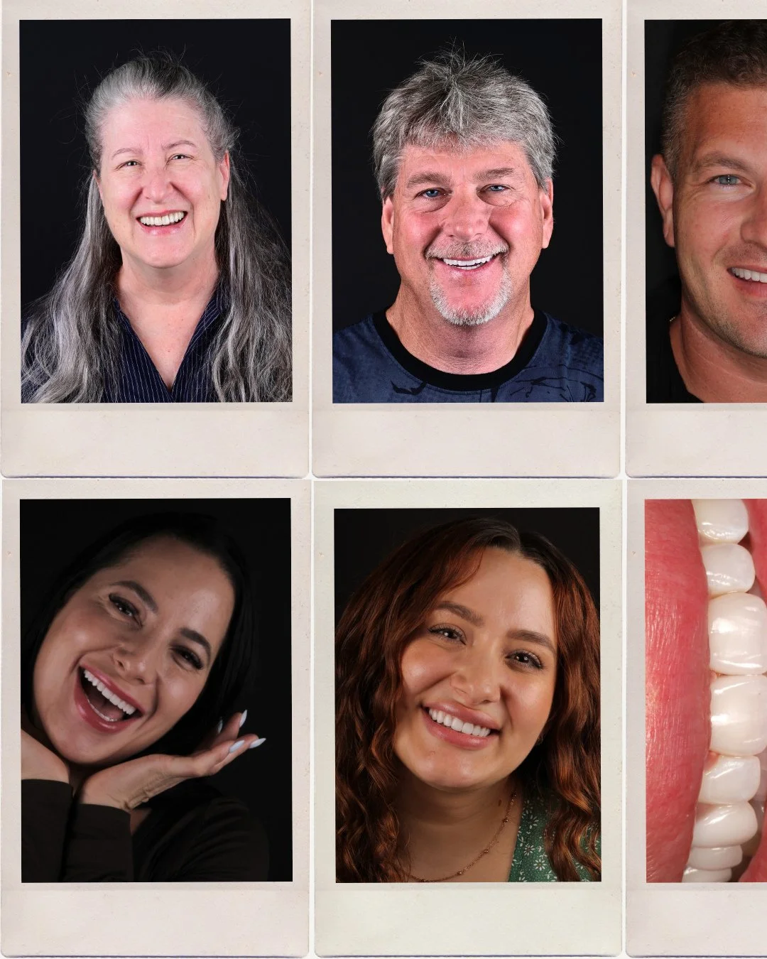 One of the most rewarding parts of this work is the people behind the smiles.⁠
⁠
Every patient brings their own story, their own goals, and the trust to allow me to be part of something personal. Watching that moment when someone sees their smile and