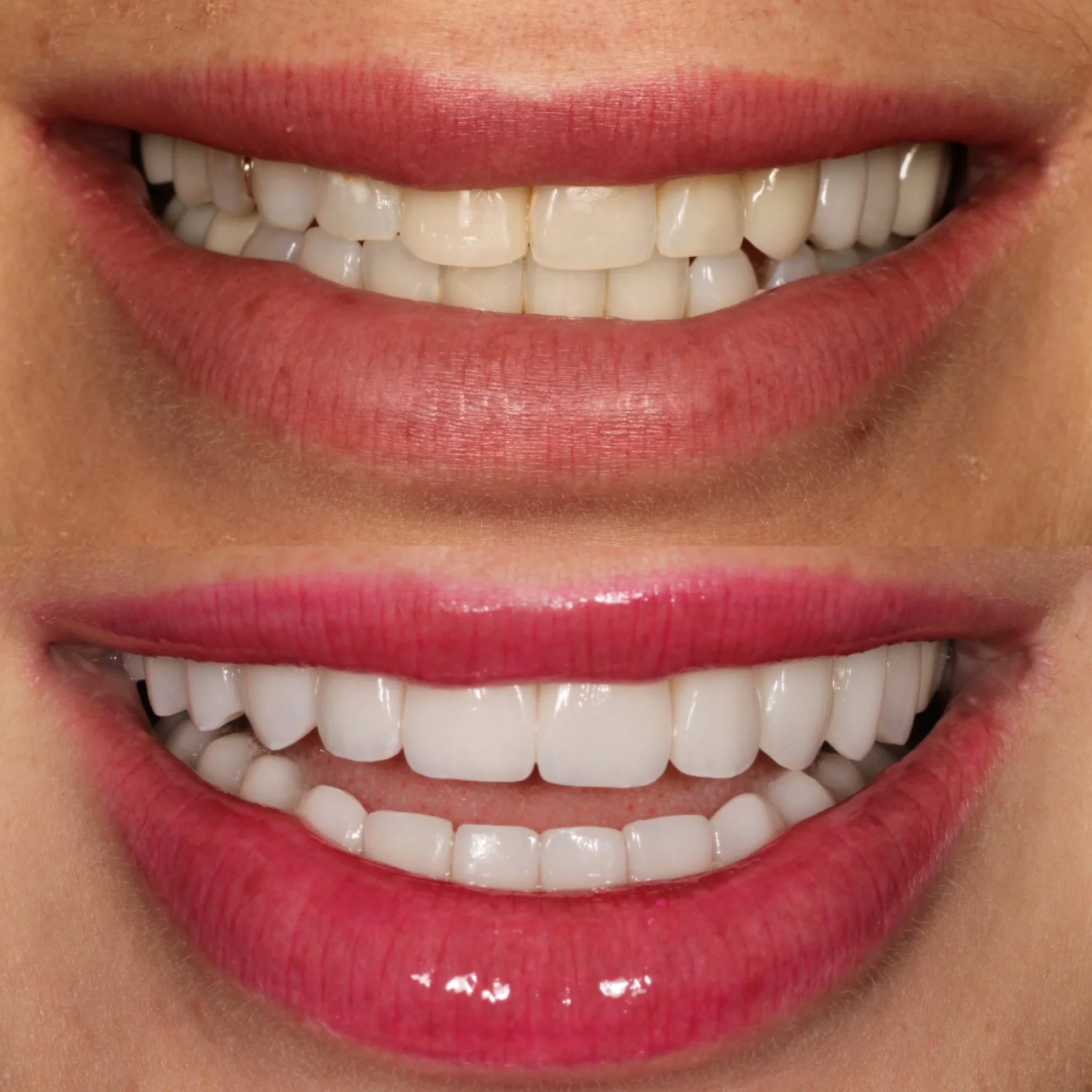 Smile Makeover Tucson