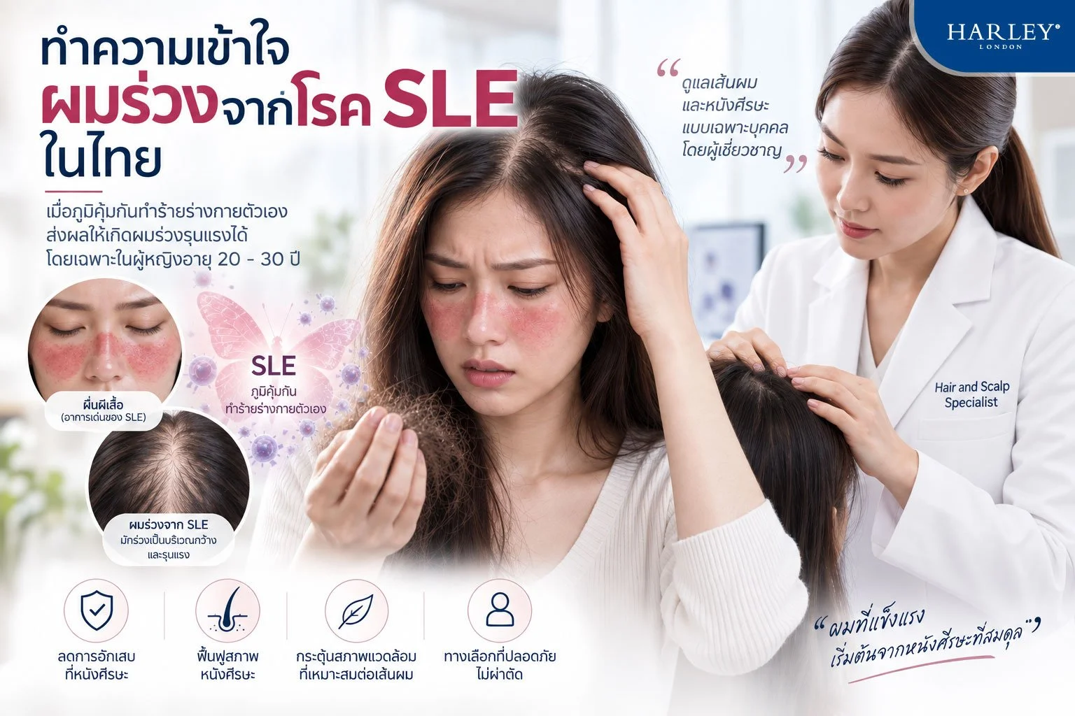 ผู้เชี่ยวชาญด้านเส้นผมและหนังศีรษะกำลังทำการส่องหนังศีรษะในระดับไมโครสโคปให้กับผู้ป่วยที่กำลังฟื้นฟูจากภาวะผมร่วงจากโรค SLE