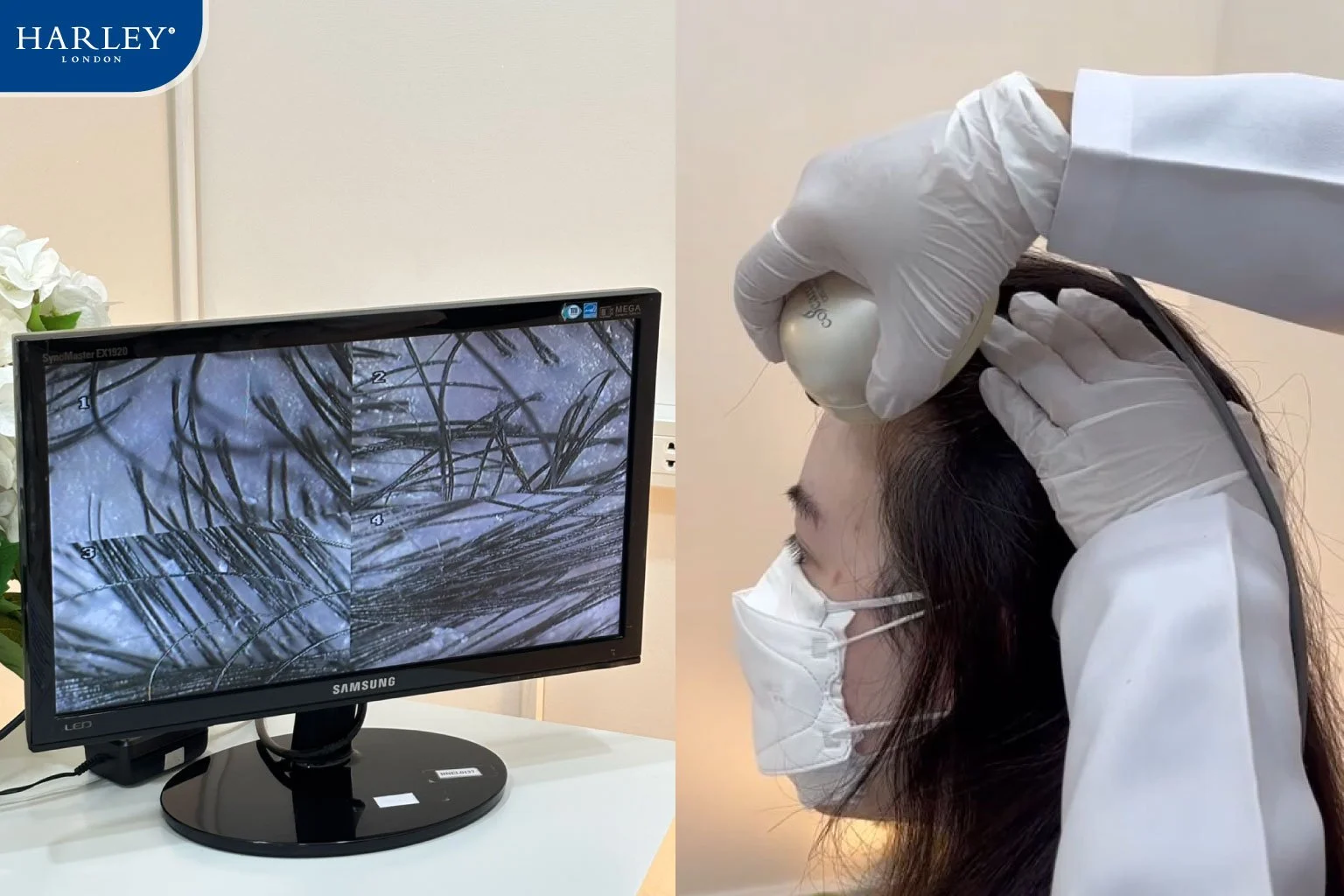 ผู้เชี่ยวชาญส่องกล้องตรวจวิเคราะห์รากผมและหนังศีรษะเจาะลึก Scalp Analysis ที่ Harley St. Hair Centre