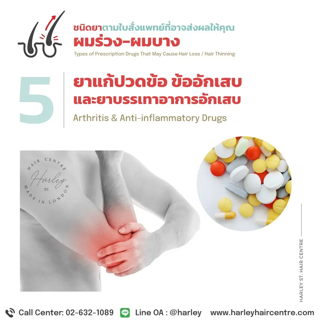 ยาแก้ปวดข้อและยาต้านการอักเสบ: ผลข้างเคียง "ผมร่วง" ที่เกิดจากระบบภายใน
