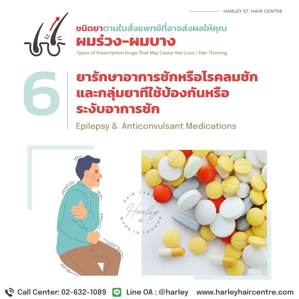 ยากลุ่มต้านอาการชัก: ผลข้างเคียง "ผมร่วงหนัก" และ "น้ำหนักตัว" ที่ต้องเฝ้าระวัง
