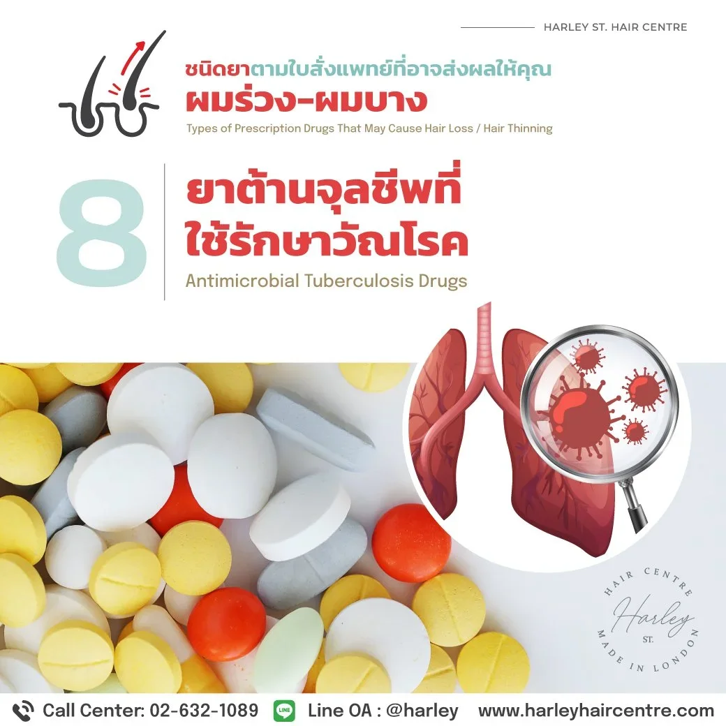 วัณโรคและยาต้านจุลชีพ: เมื่อการรักษาโรคติดต่อส่งผลกระทบต่อเส้นผม