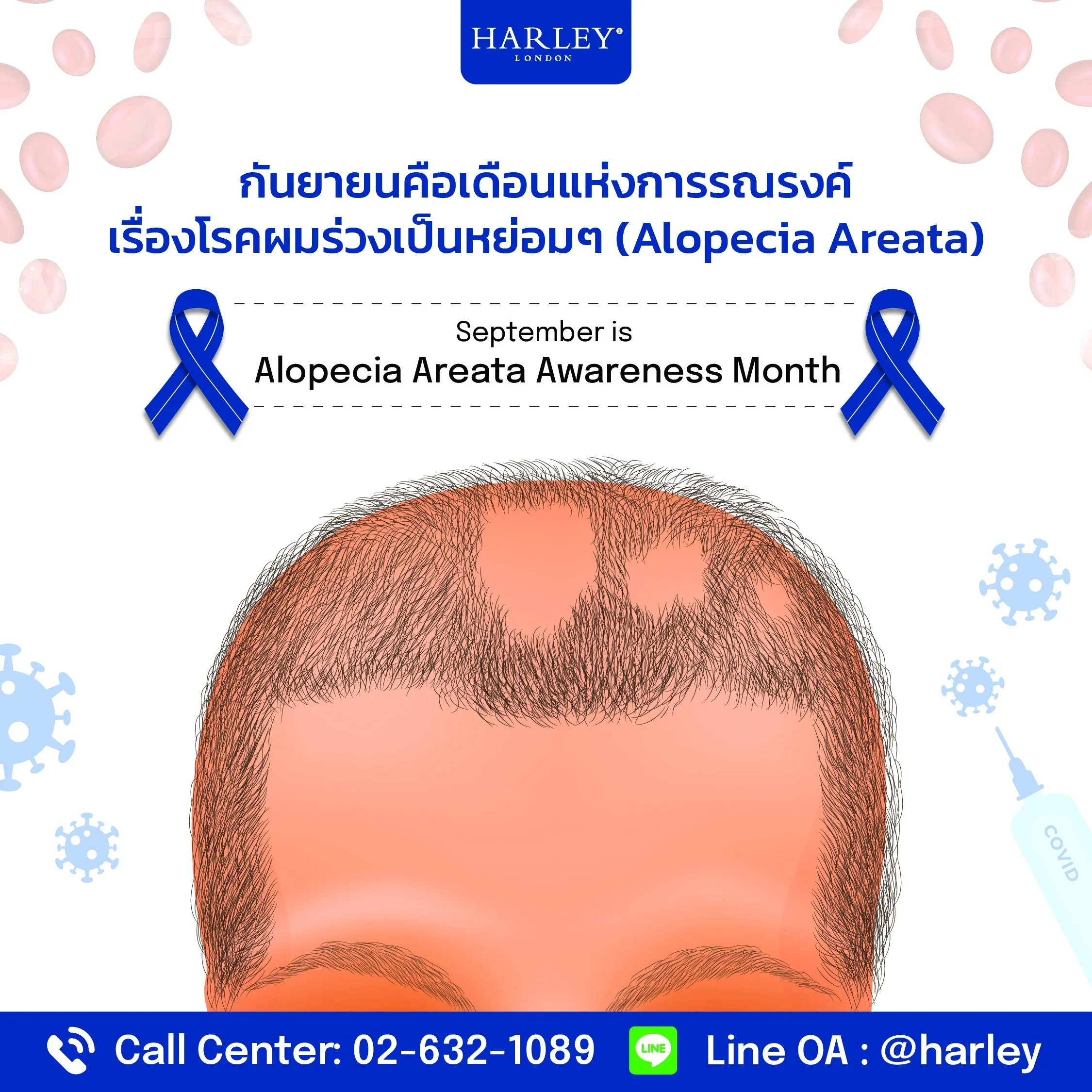 ภาพกราฟิกการรณรงค์เรื่องโรคผมร่วงเป็นหย่อมๆ ในเดือนกันยายน
