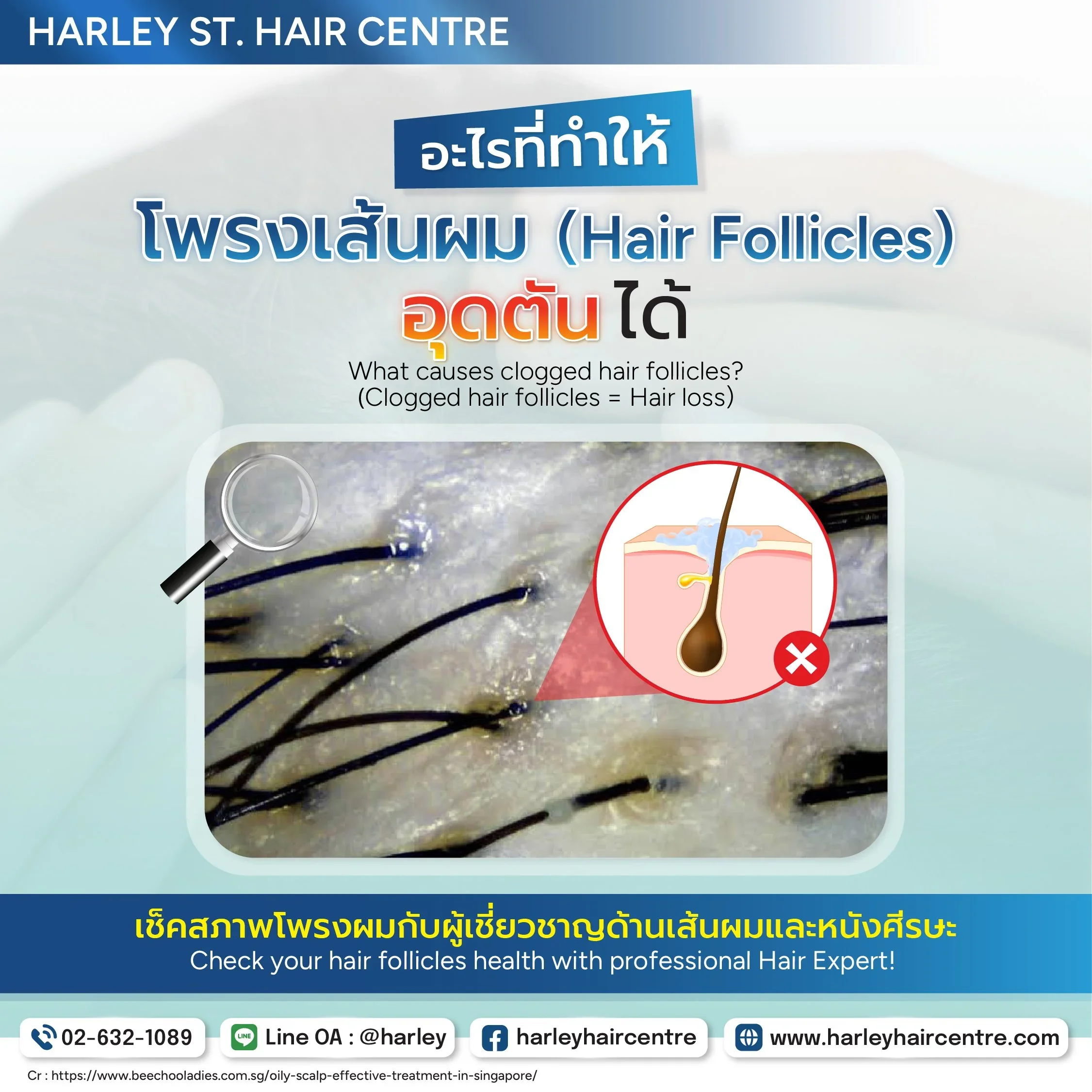 เช็กด่วน! โพรงเส้นผมอุดตัน (Clogged Hair Follicles) ต้นเหตุที่ทำให้คุณผมร่วงไม่หยุด