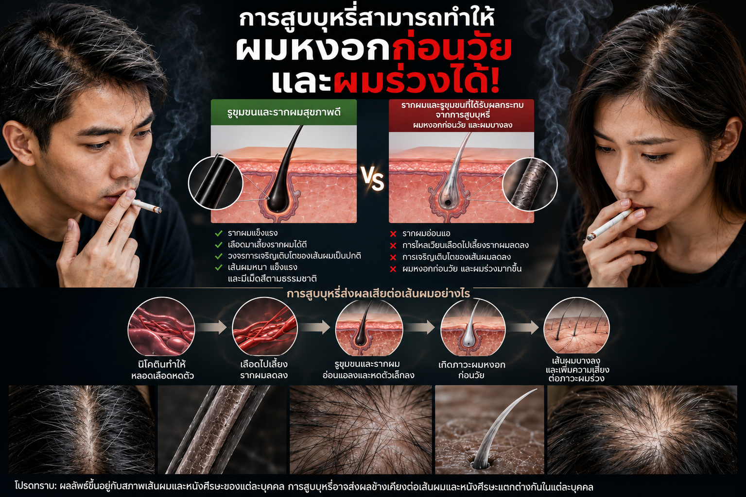 การสูบบุหรี่ทำให้เกิดผมหงอกก่อนวัยและผมร่วงจริงหรือ? ความจริงจากมุมมองด้านสารวิทยาเส้นผม