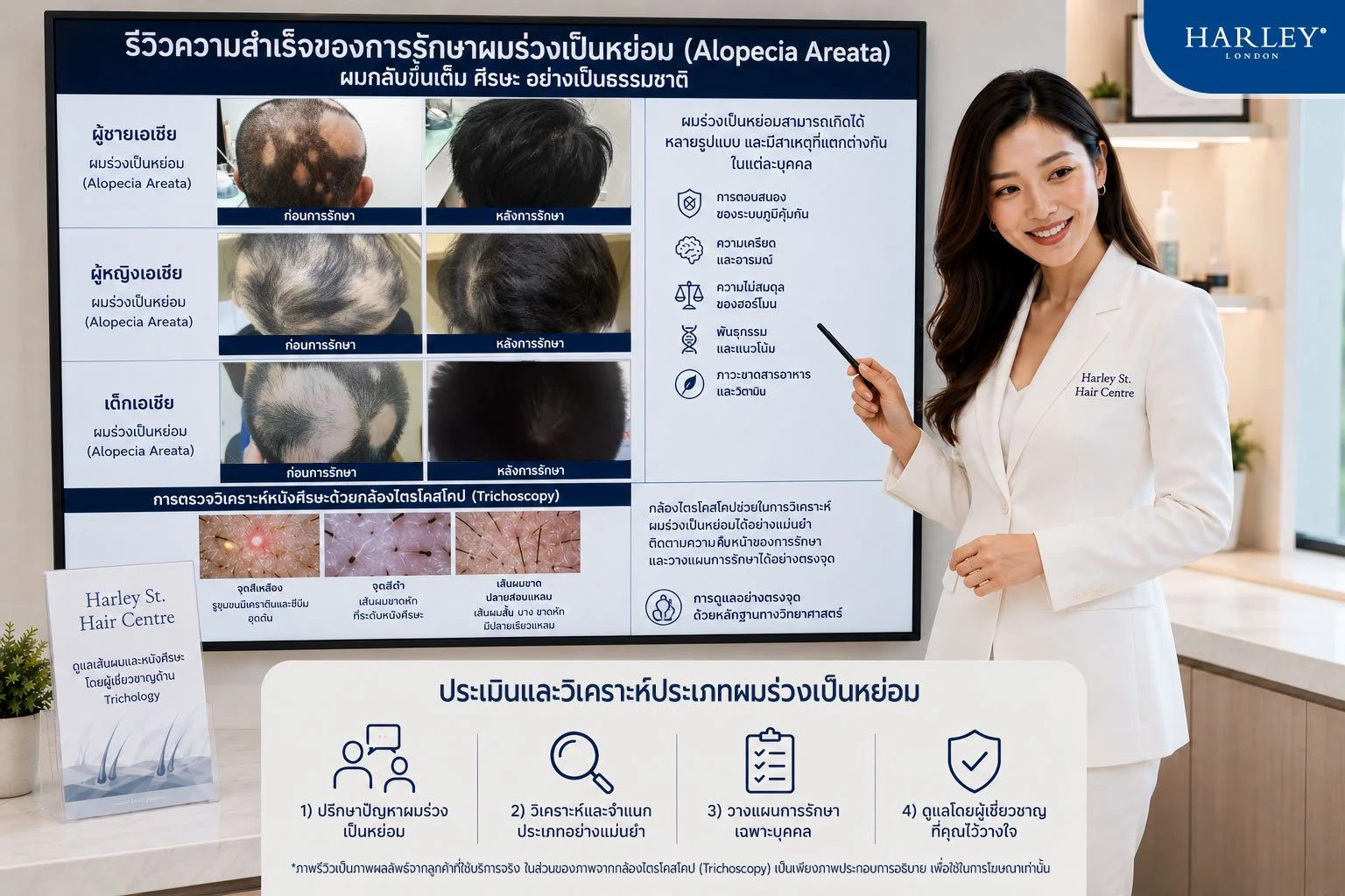 รีวิวความสำเร็จในการฟื้นฟูโรคผมร่วงเป็นหย่อมจากผู้ใช้บริการจริง: หนทางสู่การงอกใหม่ของเส้นผมอย่างปลอดภัยและยั่งยืน