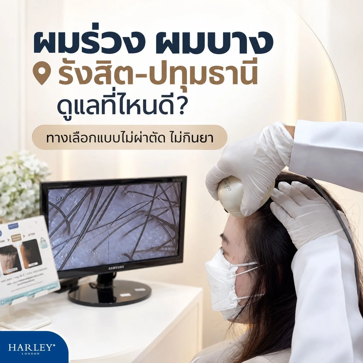 ผมร่วง ผมบาง รังสิต–ปทุมธานี ดูแลที่ไหนดี? ทางเลือกแบบไม่ผ่าตัด ไม่กินยา