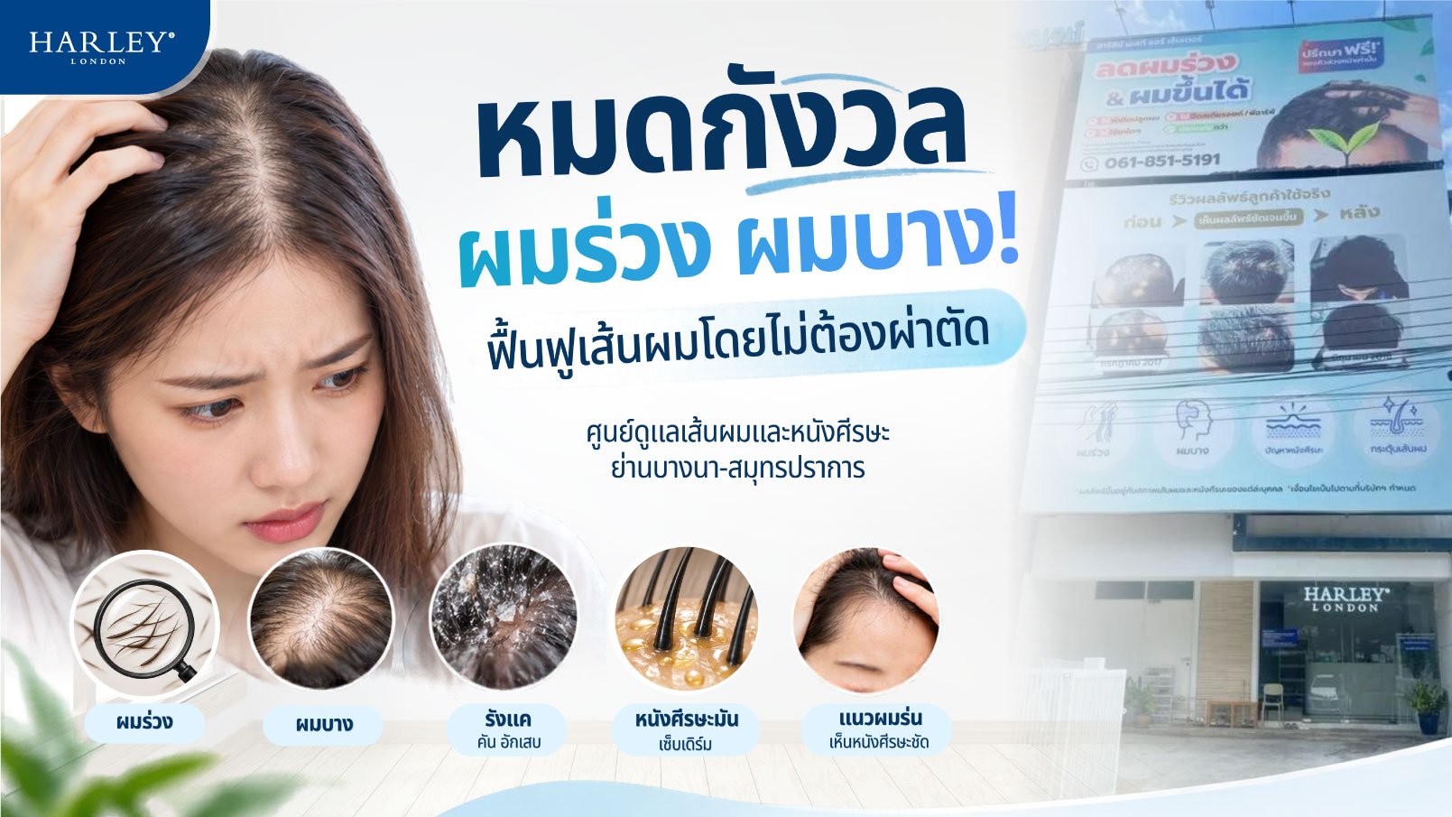 หมดกังวลผมร่วง ผมบาง ฟื้นฟูเส้นผมโดยไม่ต้องผ่าตัด ศูนย์ดูแลเส้นผมและหนังศีรษะ ย่านบางนา-สมุทรปราการ Harley St. Hair Centre