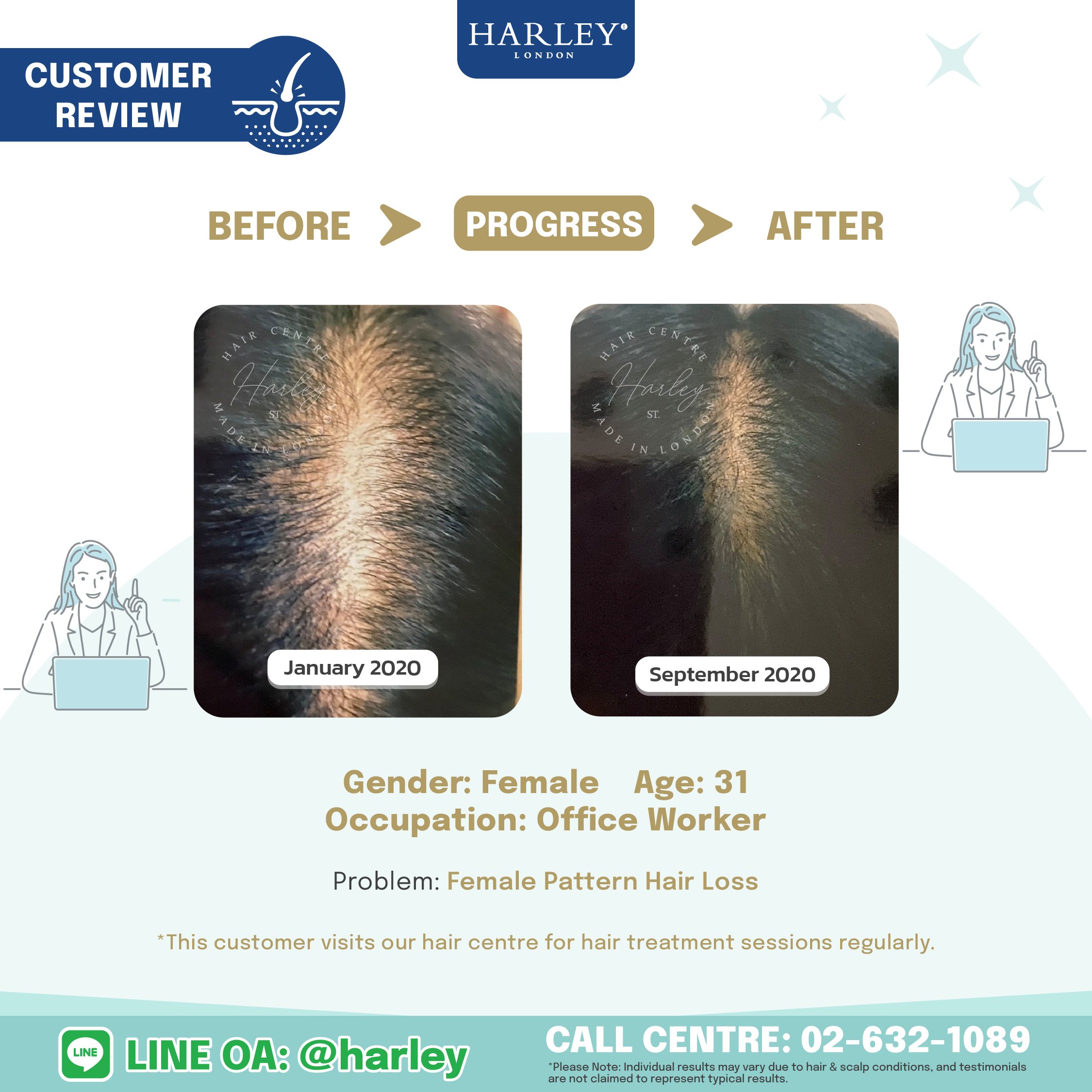 testimonials from women aged 31, helped her restore her hair's health and thickness hair transplant no surgery