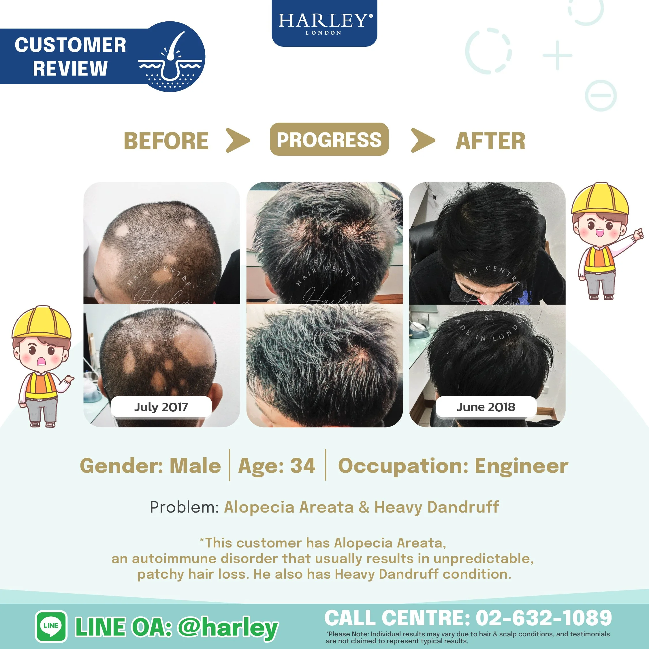 testimonials from men who have achieved transformative results from Alopecia Areata