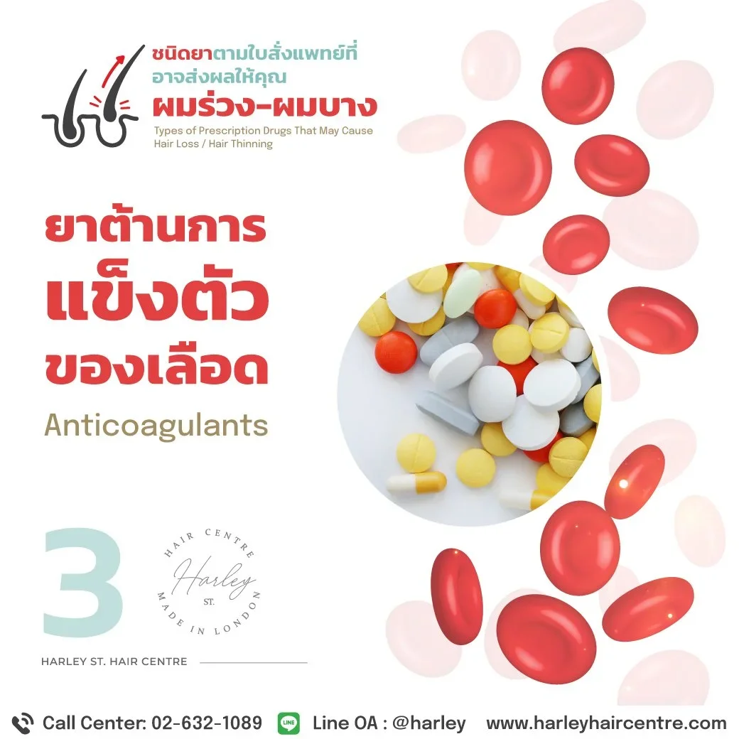 ลักษณะผมร่วงเป็นหย่อม (Alopecia) และผมบางจากการใช้ยาต้านการแข็งตัวของเลือด (Anticoagulants) ต่อเนื่อง พร้อมแนวทางดูแลโดย Harley St. Hair Centre
