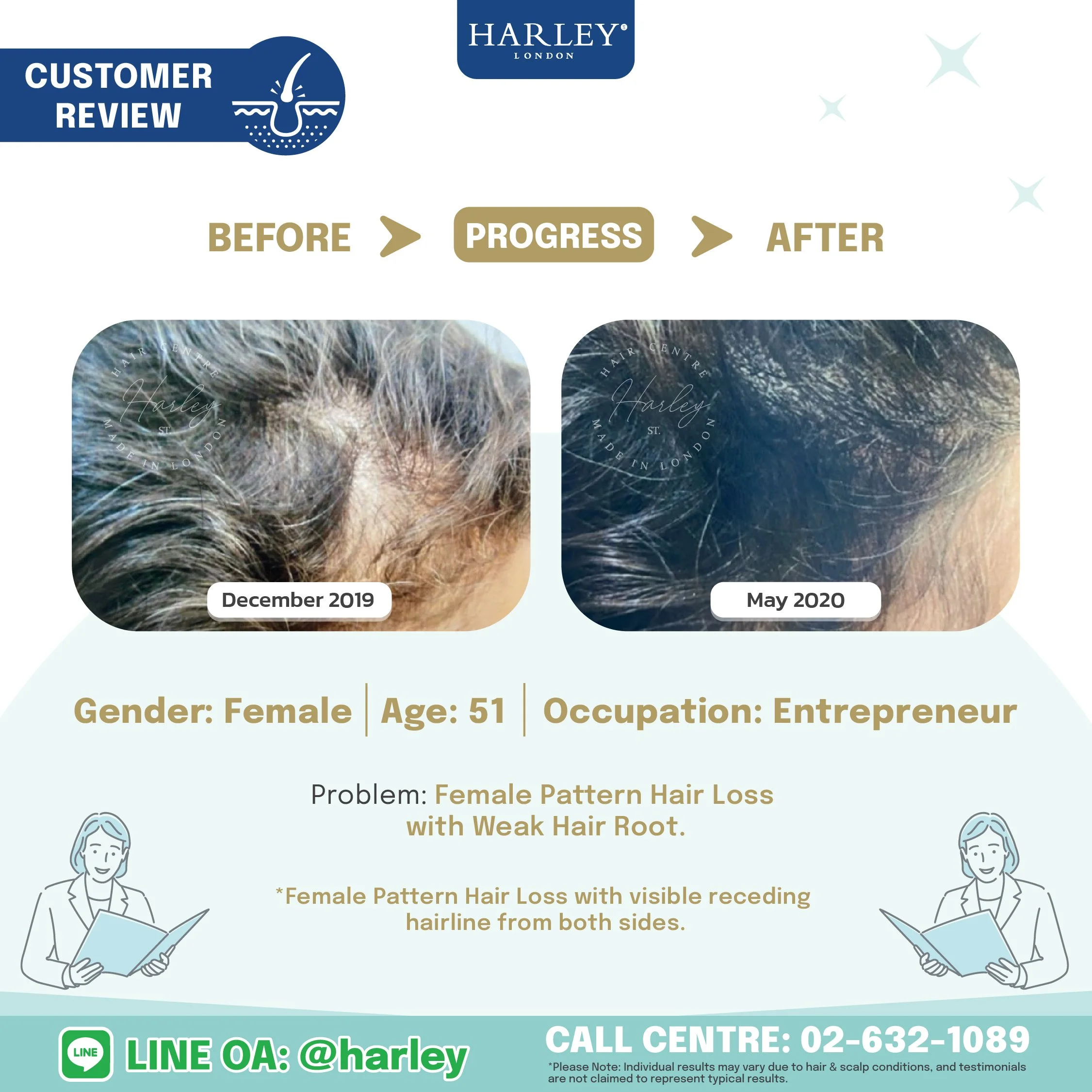 testimonials from women aged 51 hair thinning, Anti Hair loss Program helped her restore her hair's health and thickness hair transplant no surgery
