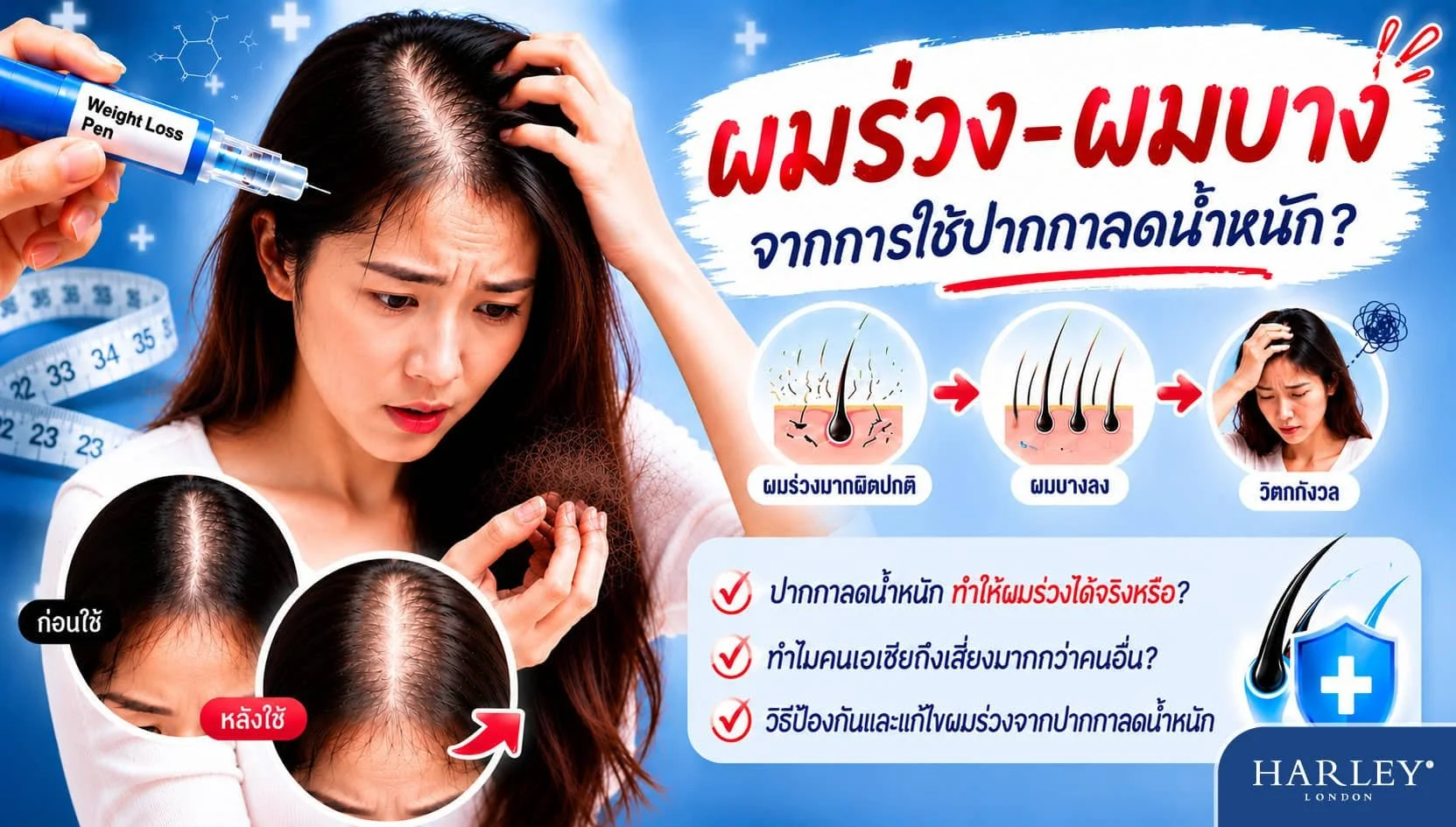 ผู้หญิงกังวลปัญหาผมร่วง-ผมบางจากการใช้ปากกาลดน้ำหนัก