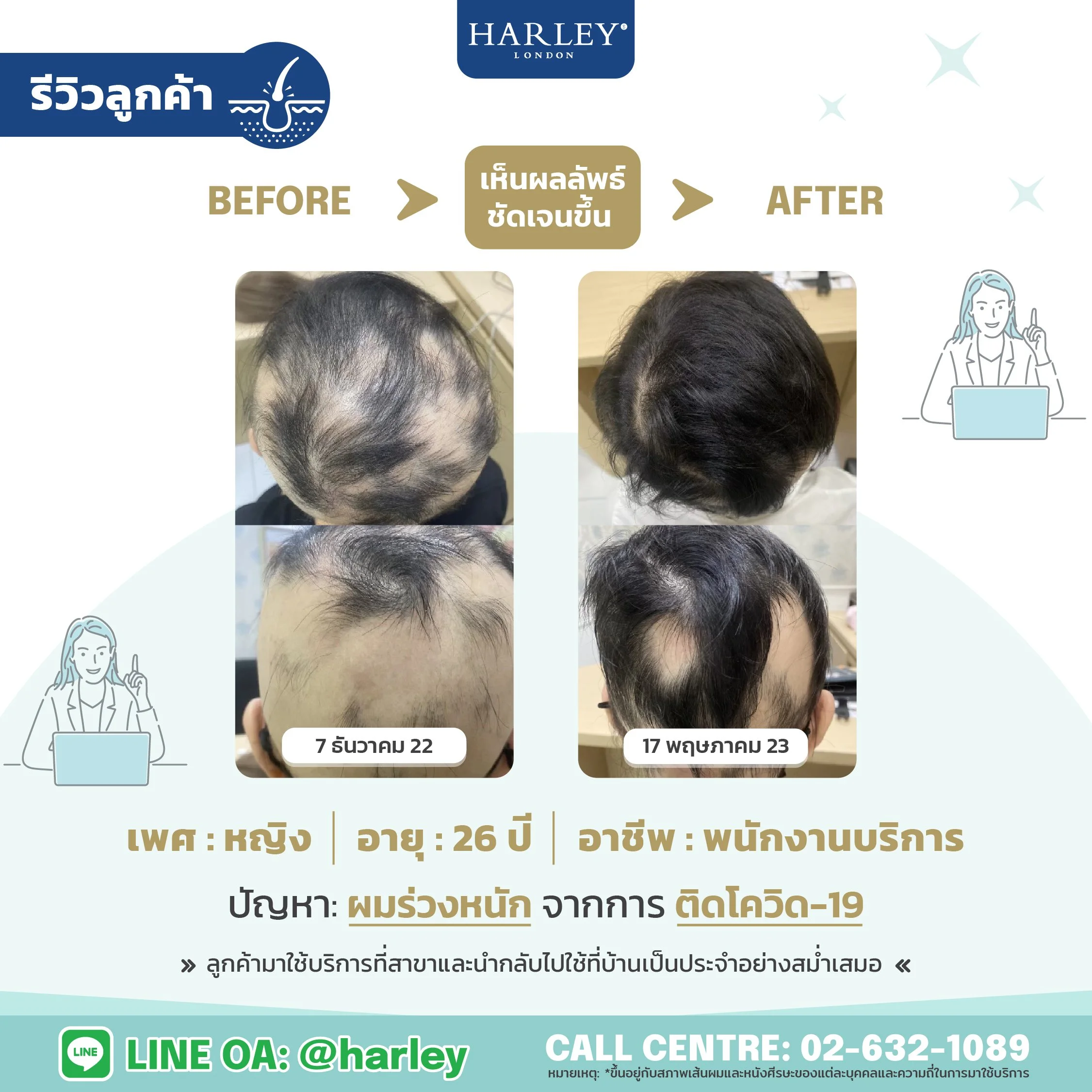 รีวิวลูกค้าเพศหญิงอายุ 26 ปี ผมร่วงหนักจากโควิด 19