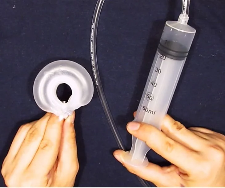 Person holding a heart-shaped and donut-shaped silicone catheter balloon with a syringe and clear tubing.