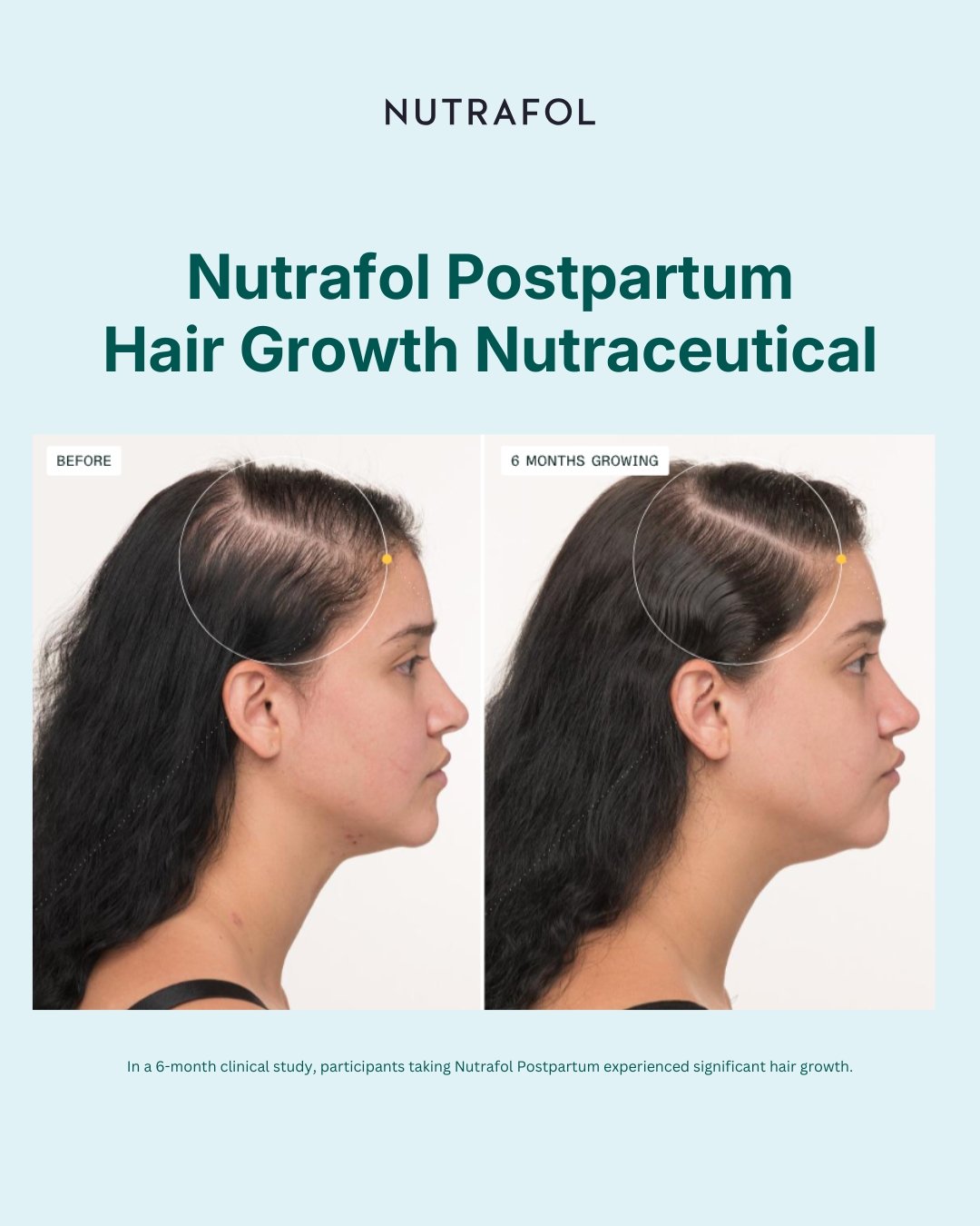 Before & After-Postpartum 1.JPG (Copy)