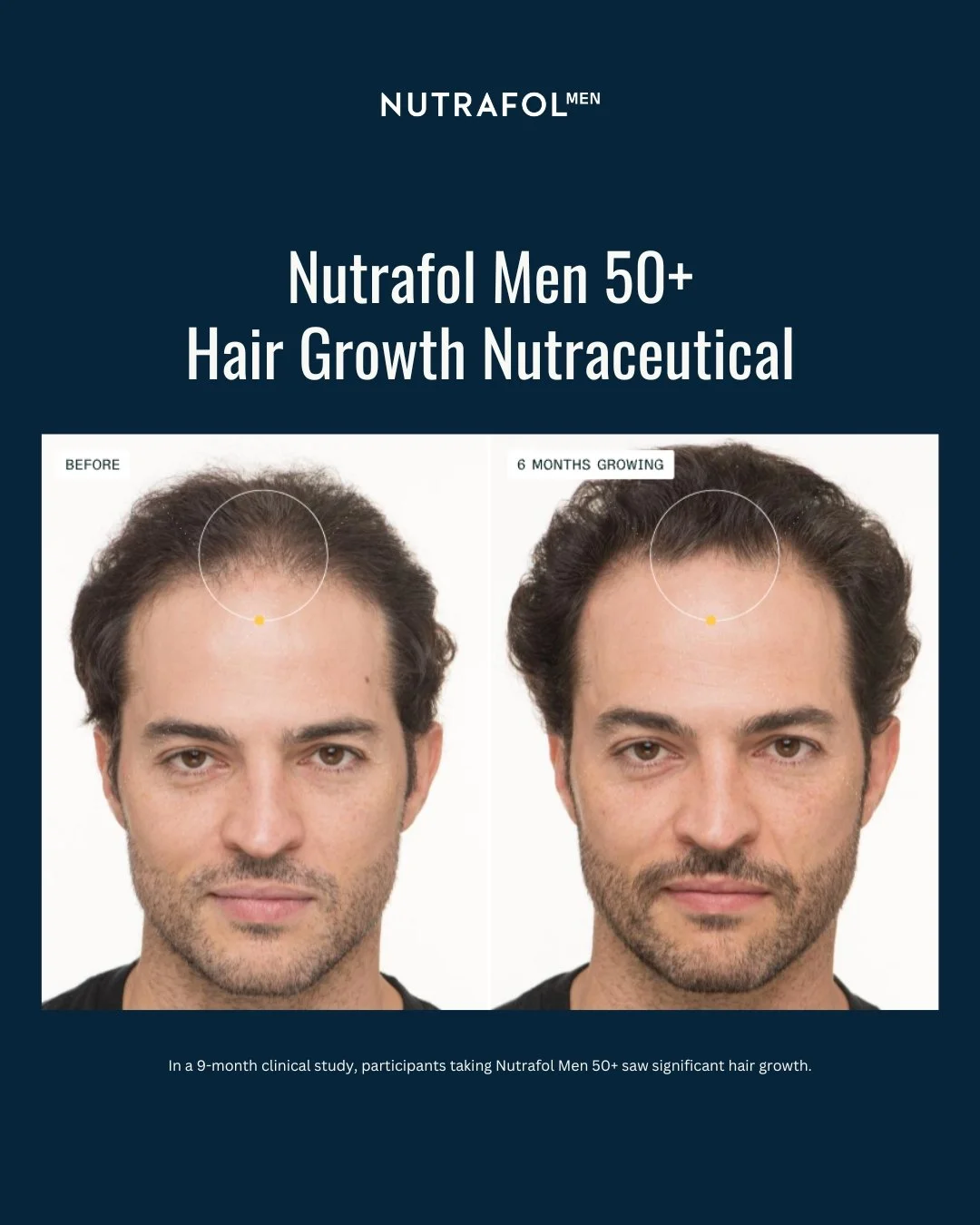 Before & After Photo-Men 50+ 1.PNG (Copy)