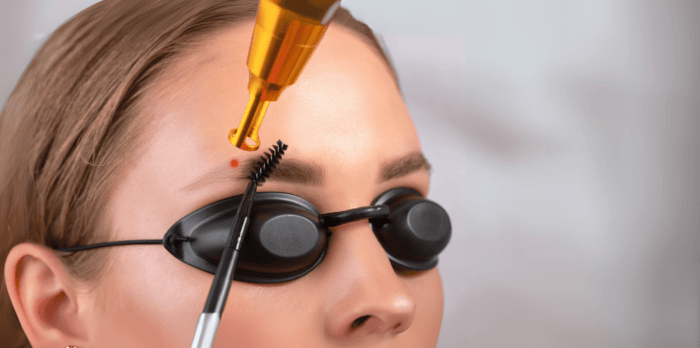 Tattoo-removal-brows-e1736951404860-700x348.png