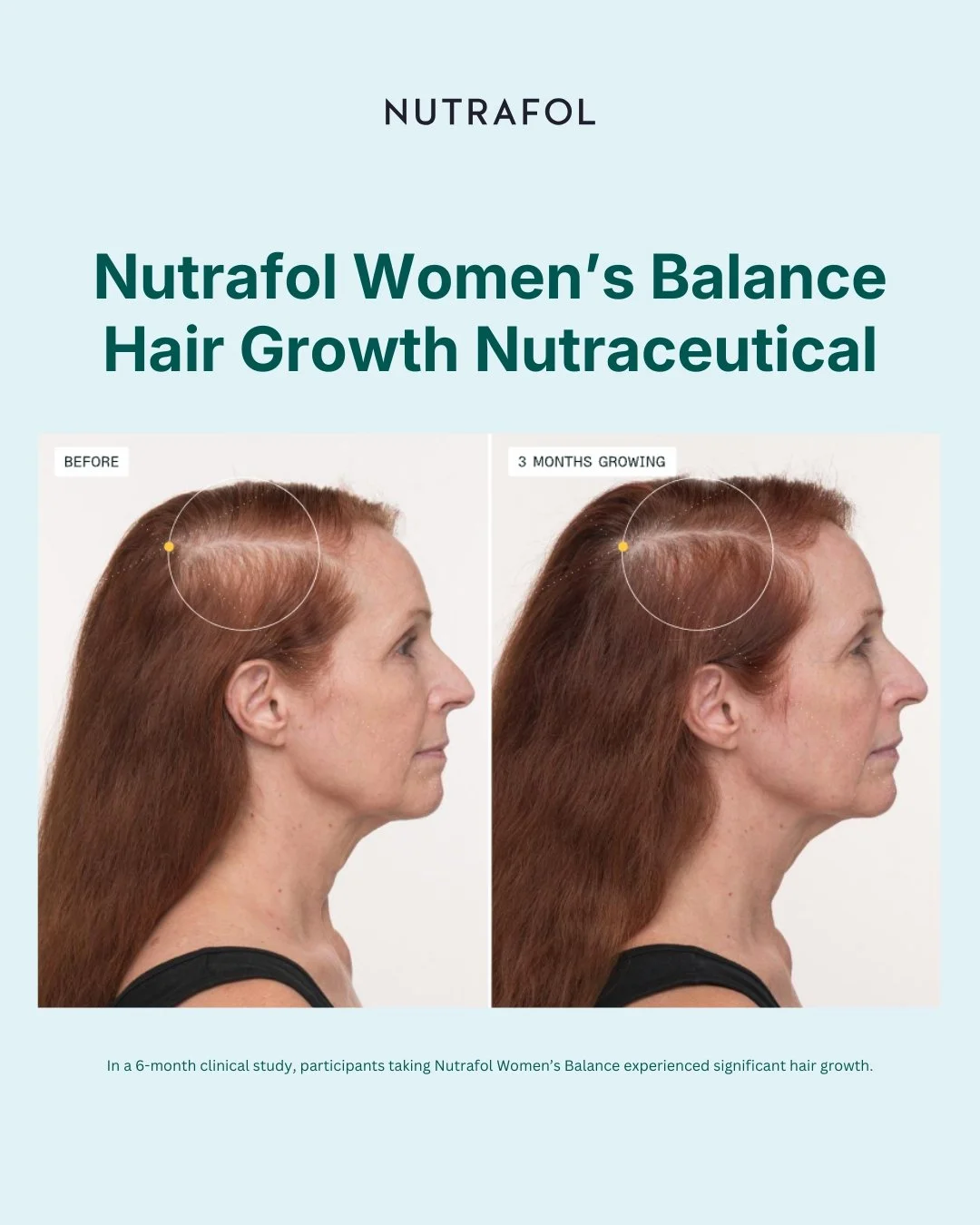 Before & After Photo-Women's Balance 1.JPG (Copy)