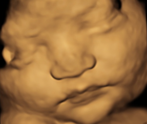 Person holding a 3D ultrasound image of a fetus