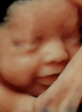 Ahwatukee Ultrasound HD live, mom to be with father holding elective 2d ultrasound. Family Friendly.