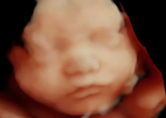 5D ultrasound image of a sleeping fetus in the womb.