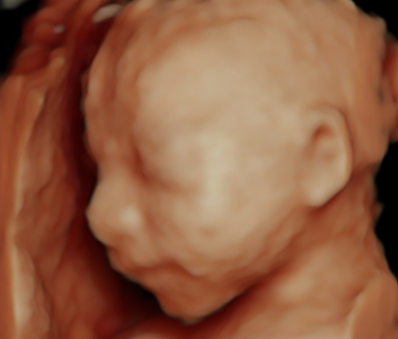 Pregnant woman holding ultrasound picture in front of her belly outdoors with yellow flowers in the background.