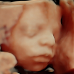 Close-up 5D ultrasound image of a sleeping baby's face with eyes closed. Image acquired by Little Buns Ultrasound and Baby Boutique in Chandler AZ.