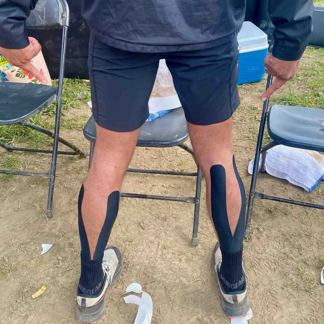 Wrap It Up: Taping Techniques for a Happy Achilles