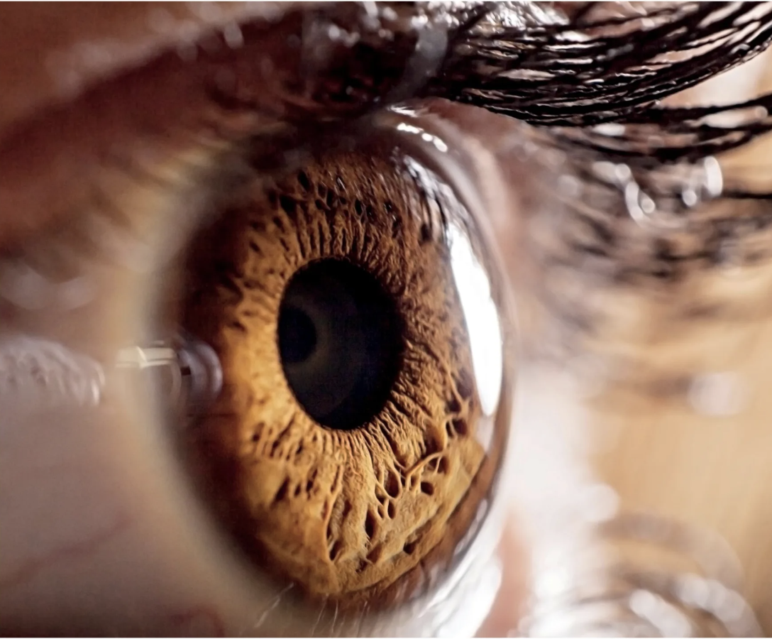 Reversing Dermal Filler Blindness