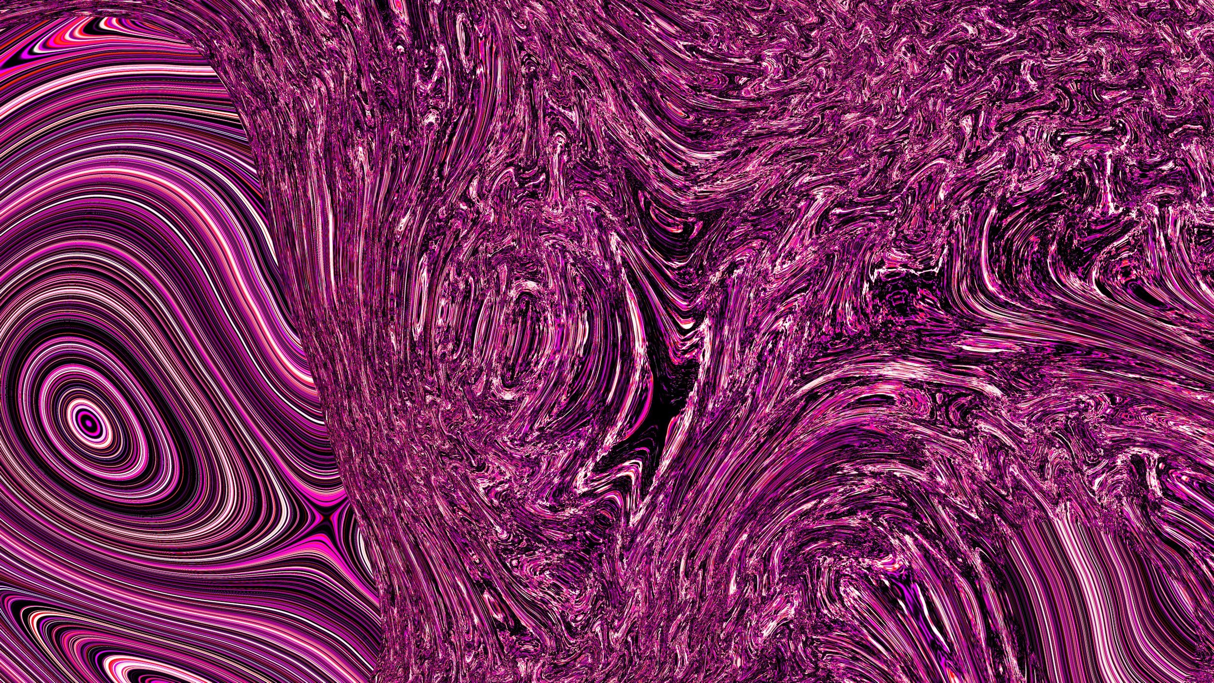 Can Psychotherapy Help with Fibromyalgia? Understanding the Mind–Body Connection