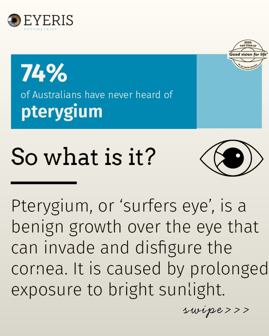 What is Pterygium? And what can we do about it?

That little growth on the white of your eye isn&rsquo;t just cosmetic. Pterygium is often linked to UV exposure, wind, and dry environments. Left unchecked, it can cause irritation, redness, and even a