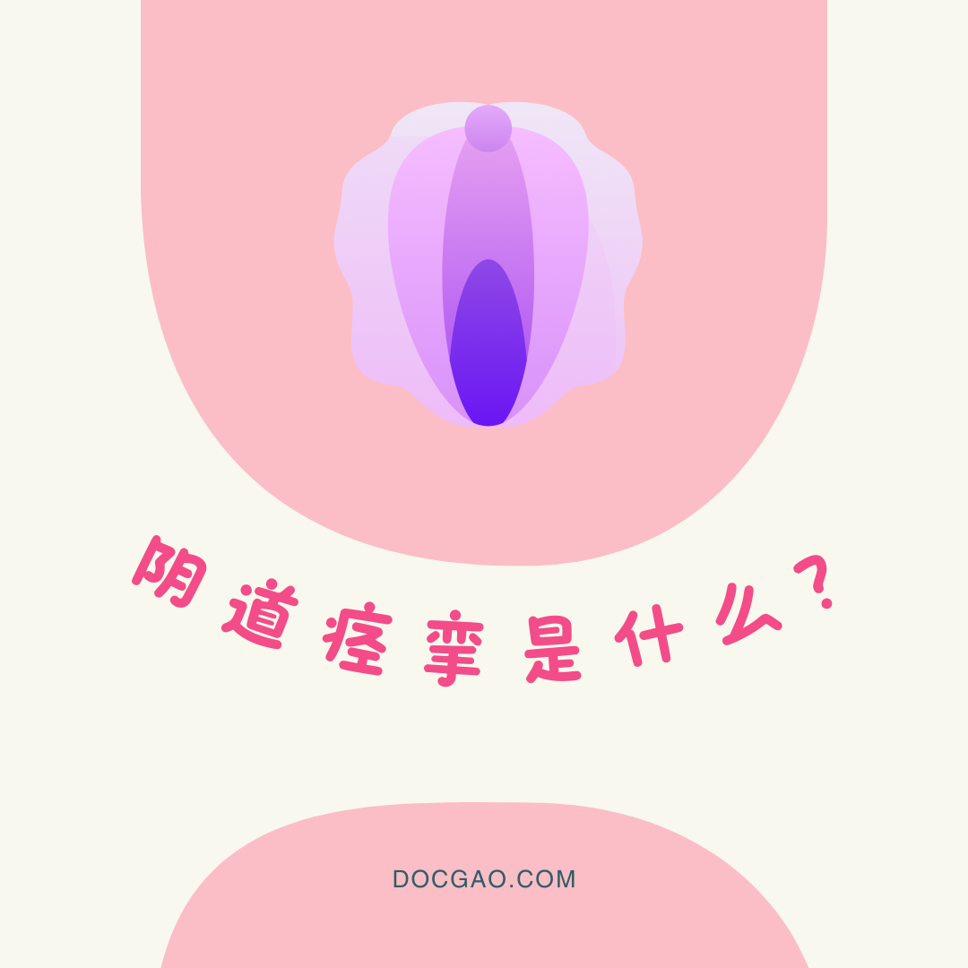陰道痙攣：成因及治療 