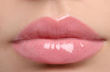 Female with full lips representing lip filler services offered at Evo Med Spa, Spokane