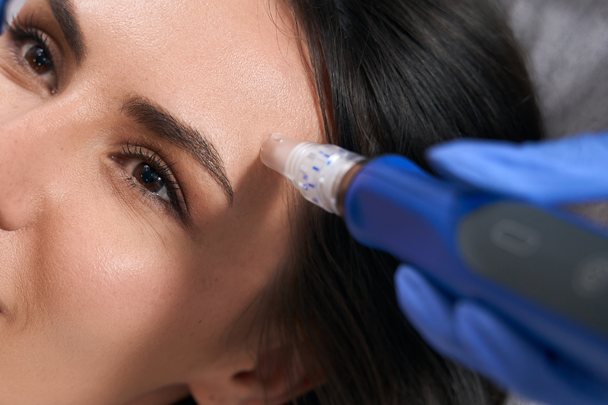 SkinPen® Microneedling Aftercare