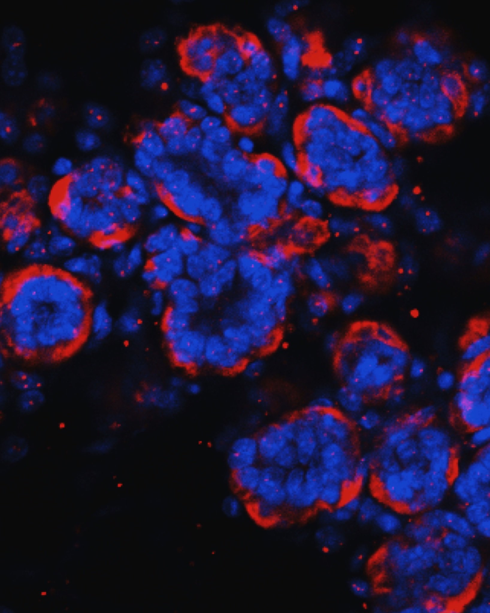 Mammary tissue of lactating female mouse labeled with DAPI and Oxytocin receptor antibody.