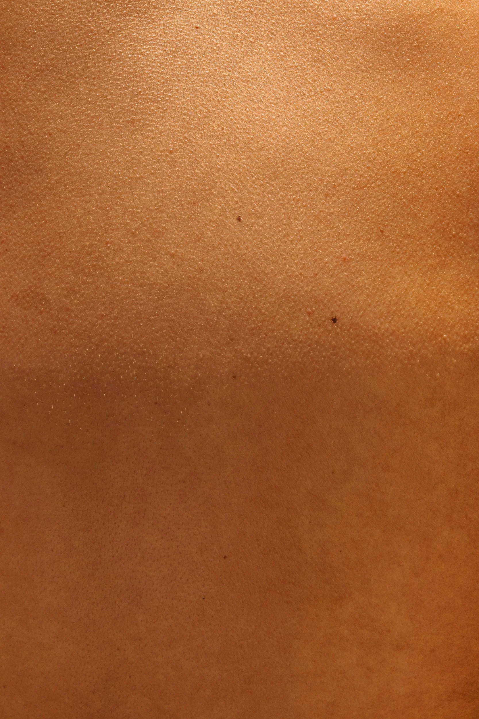 a close up of skin with natural bumps and texture