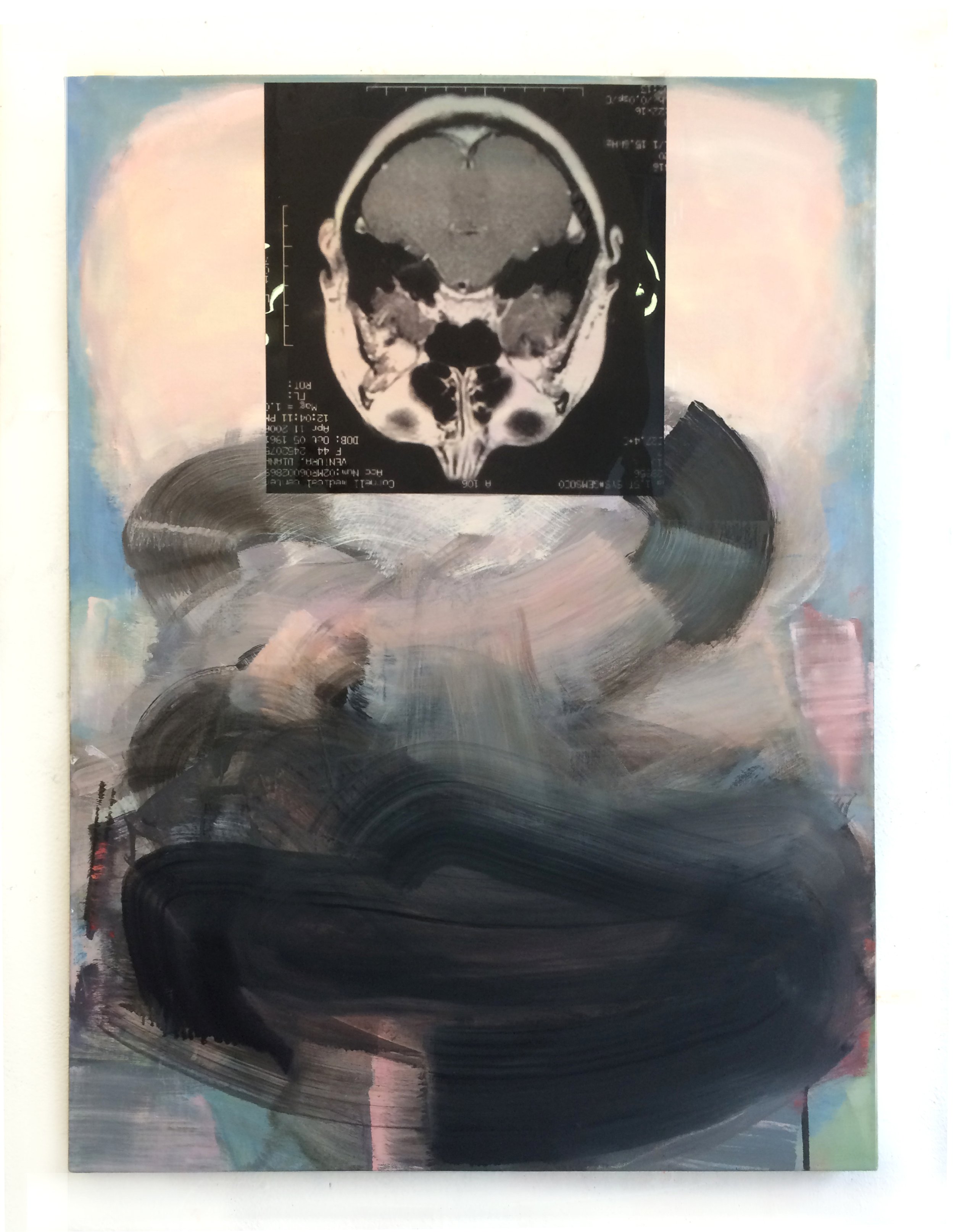 “Spring,” 2020. Oil, spray paint, X-ray acetate print on linen – 40” x 30”