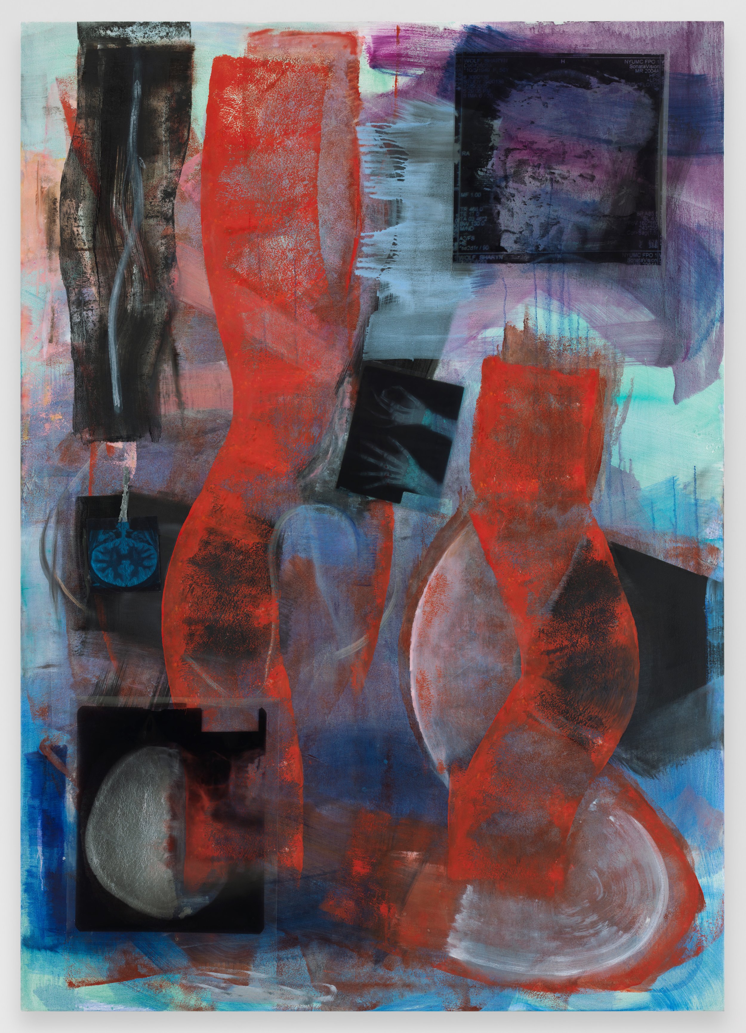 “Melancholia,” 2018. Oil, spray enamel, aluminum leaf, and acetate X-Ray prints on canvas – 76” x 54”