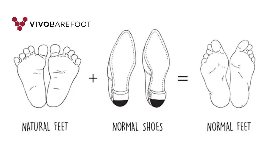 Normal-Feet-vs-Natural-Feet-Vivobarefoot.jpg