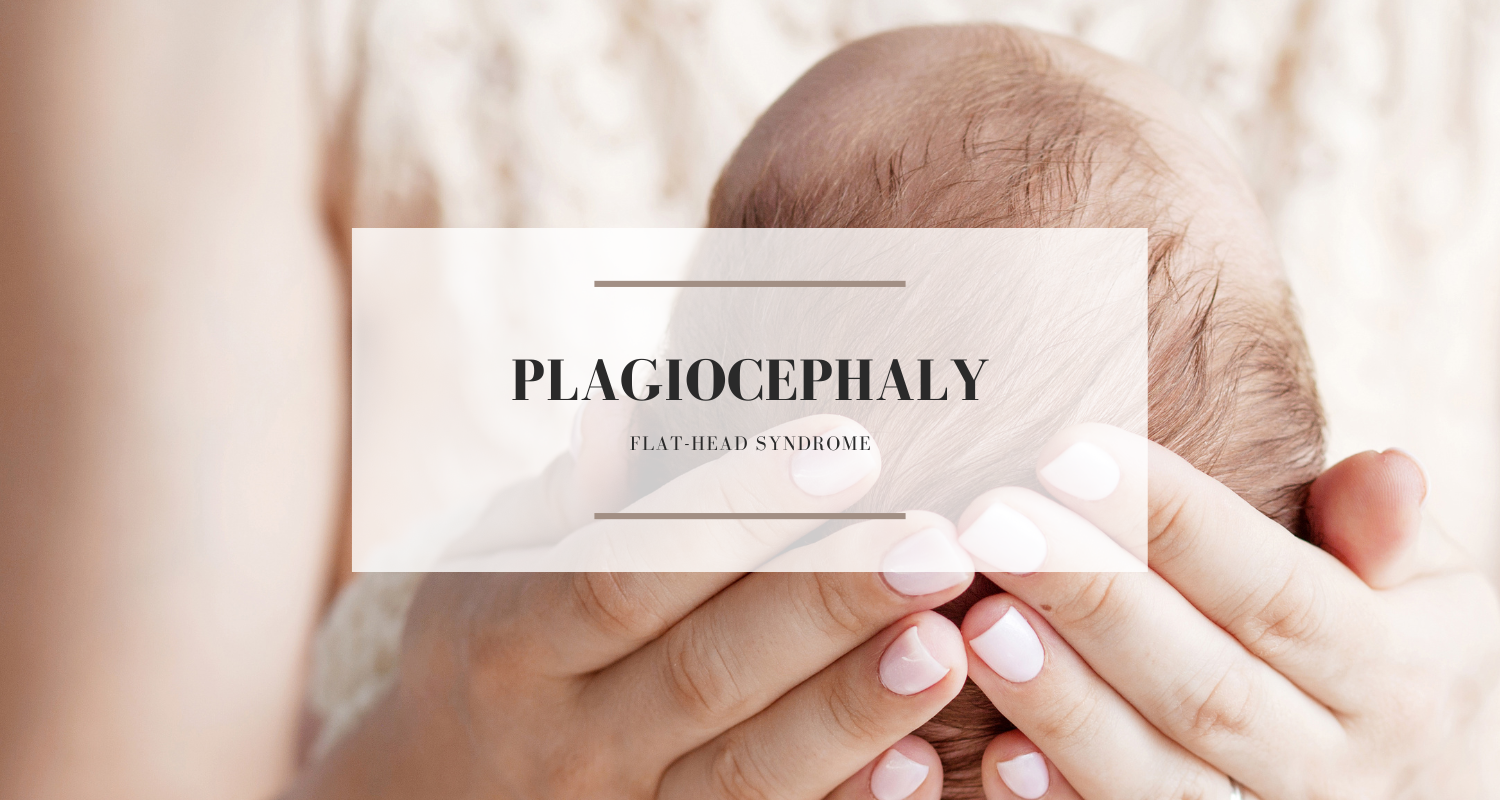 Plagiocephaly