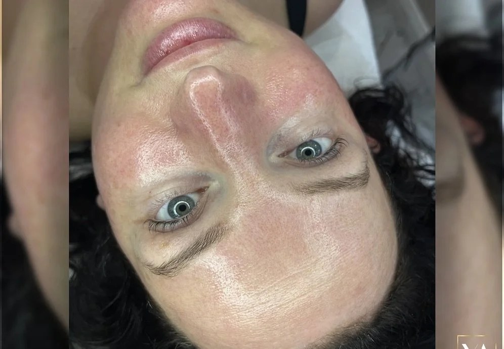 ✨Glass Skin Facial ✨

In the last post, you found out more about what the 🌟 Glass Skin Facial 🌟 treatment is.

We already know that the treatment involves thorough CLEANSING, MOISTURISING, and NOIRISHING of the skin, ensuring it is free from imperf