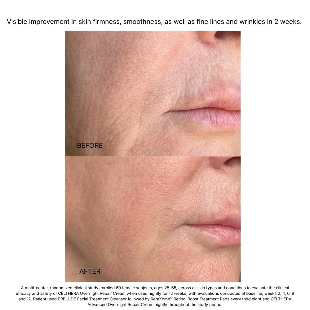 Hydrinity-celthera-advanced-overnight-repair-cream-b_A_ddb0ed68-3b02-4270-8a5a-eab053c8d212.jpg.webp