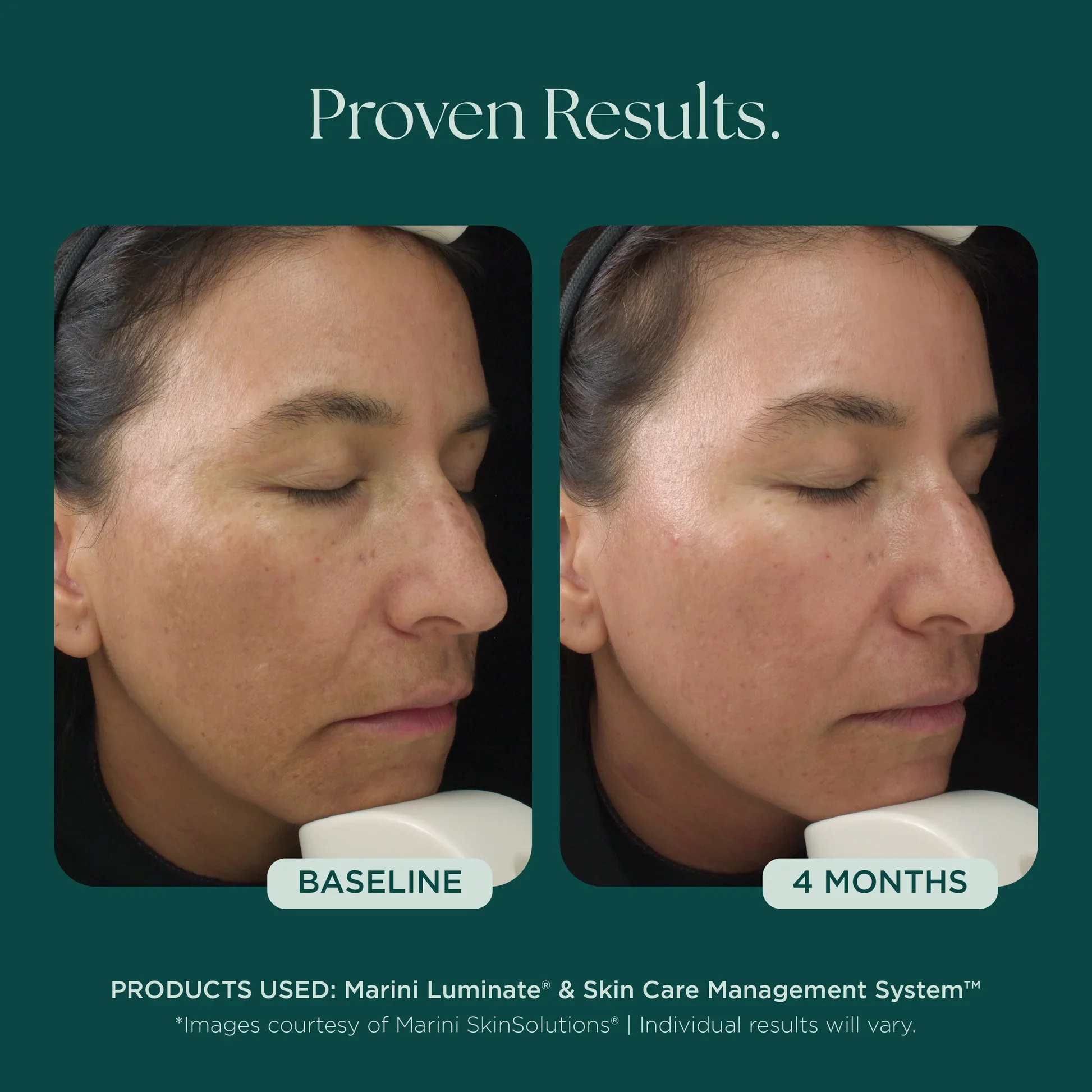 MSS26_Shopify_ProductPage_Before_Afters_DISCOLORATION_042726__DISCOLOR-8005.jpg.webp