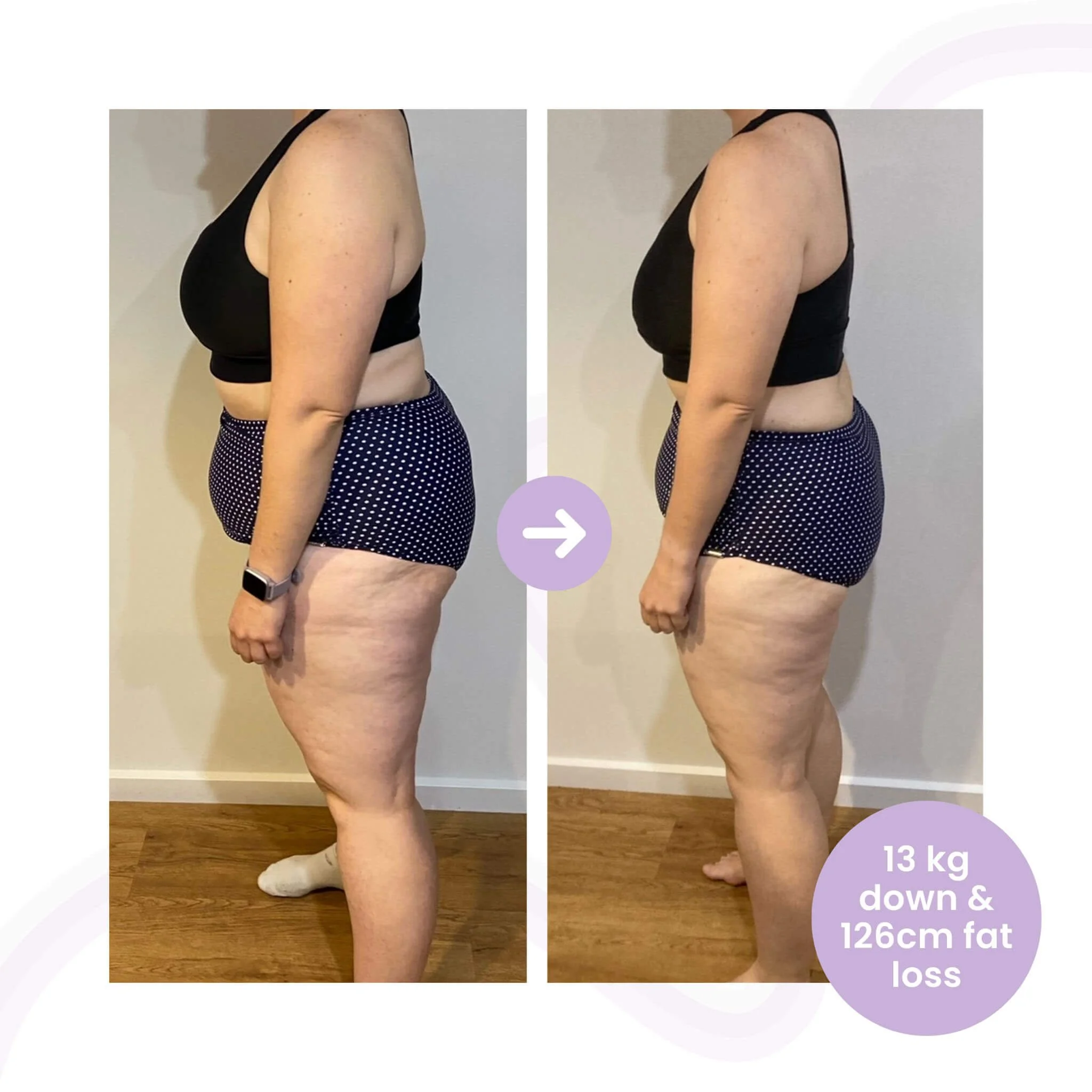 Female client weight loss before and after transformation